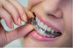 Book Braces Appointment Near Me In USA - DentalSave Dental Plans