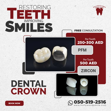 Dental Crown in Dubai