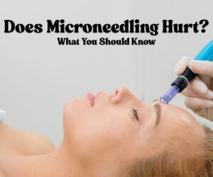 Does Microneedling Hurt – What You Should Know