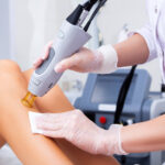 Laser Hair Removal for Sensitive Areas Safe or Not