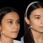 Best Plastic Surgeons in dubai