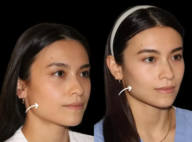 Best Plastic Surgeons in dubai