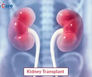 Kidney Transplant Surgery in India: A Lifesaving Option with Affordable Care