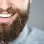 Are Beard Transplants Permanent Understanding Longevity and Results