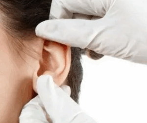 The Role of Technology in Modern Ear Reshaping in Islamabad