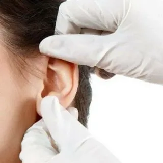 Ear Reshaping in Islamabad