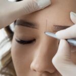 Eyebrow Transplant Recovery Tips from Dubai Experts