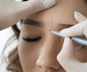 Eyebrow Transplant Recovery Tips from Dubai Experts