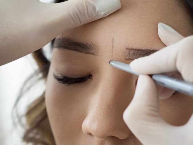 Eyebrow Transplant Recovery Tips from Dubai Experts