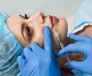 Get Fuller, Youthful Lips Without Surgery with Lip Fillers