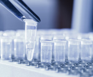 How DNA Testing Is Changing Family Trees Forever
