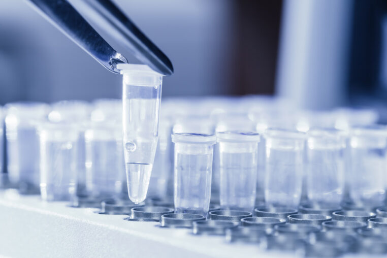 How DNA Testing Is Changing Family Trees Forever