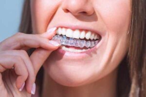 Emergency Dentist