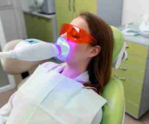 Minimising Tooth Sensitivity Throughout Whitening Treatments