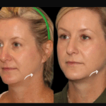 Best Plastic Surgeon in dubai