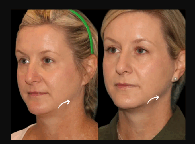Best Plastic Surgeon in dubai