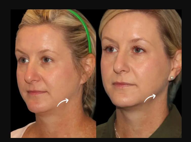 Best Plastic Surgeon in dubai
