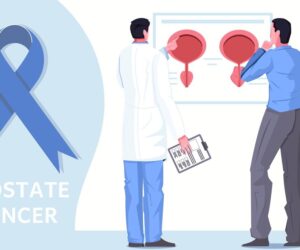 What is the Recovery Time for a Vasectomy?