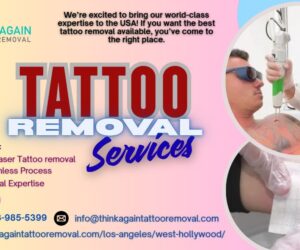 Think Again Tattoo Removal – Los Angeles