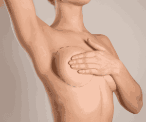 Breast Implant Surgery at Dr. Monisha Kapoor Aesthetics Best Breast Augmentation in Delhi