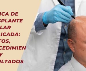 Clínica de Trasplante Capilar Explicada: Costos, Procedimientos y Resultados