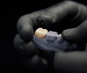 Revolutionize Patient Care with Same-Day Crowns and Bridges