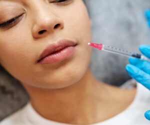 What Should I Ask During My Consultation Before Getting Lip Fillers?