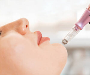 How Microneedling Enhances the Effectiveness of Topical Skincare Products