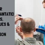 cost hair transplantation