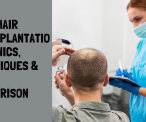 Cost Hair Transplantation: Clinics, Techniques & Price Comparison