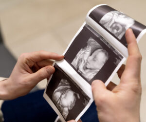 Pregnancy Ultrasound Near Bhubaneswar – Safe, Accurate & Affordable Scans at Zelife Healthcare