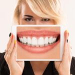 Teeth Whitening Safety Tips