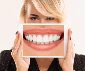 Teeth Whitening Safety Tips: Avoiding Damage While Brightening Your Smile