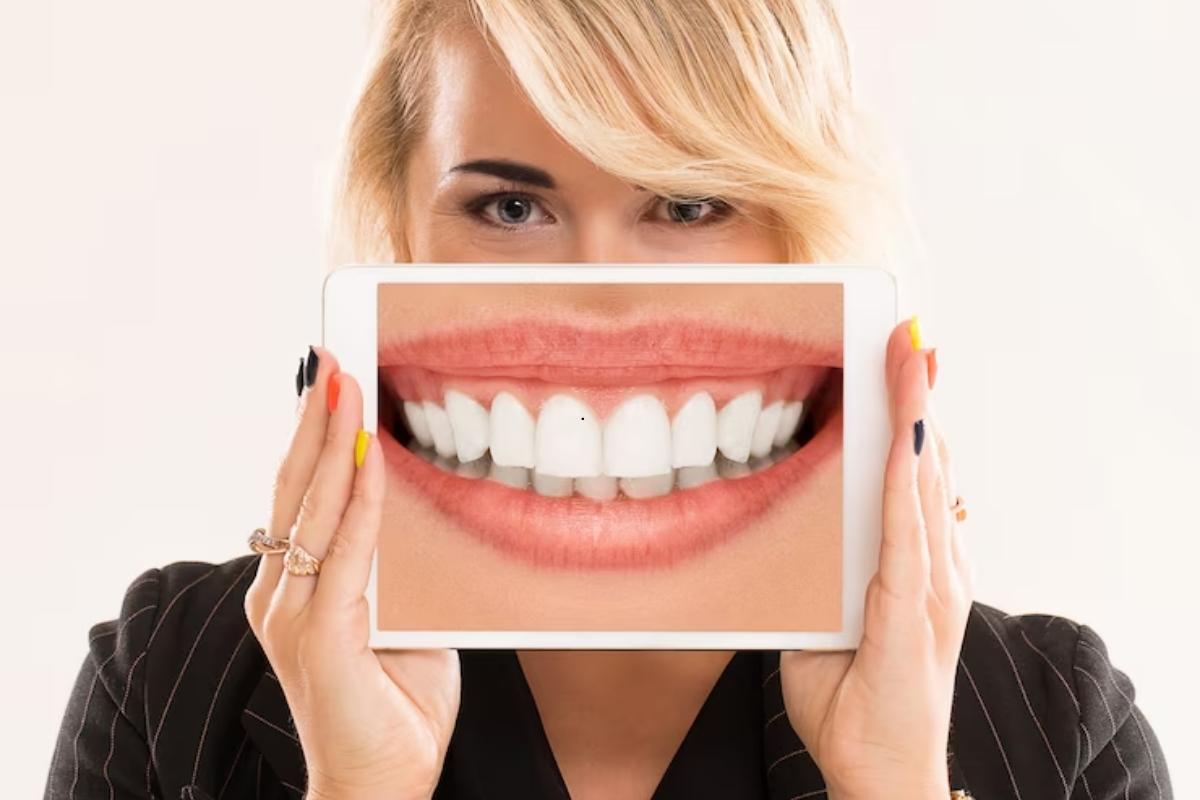 Teeth Whitening Safety Tips